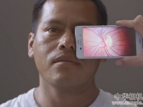 用手机的相机应用和附件实现眼科检查？