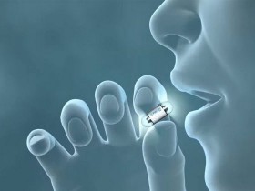 这款可吞咽的微型相机PillCam可进行结肠镜检查？！